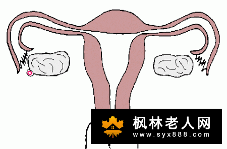 卵巢囊肿的病因是什么？