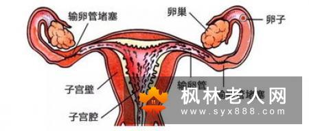 导致老年性痴呆的病因有哪些?